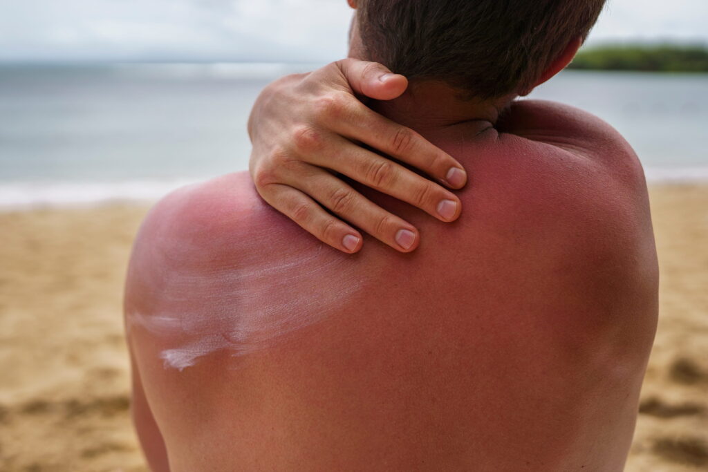 A man applying sunblock.