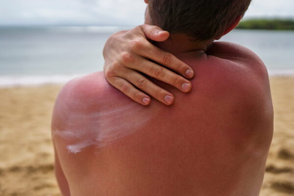 A man applying sunblock.